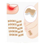 Pack 50 Parches Correctores Reparador De Uñas Encarnadas
