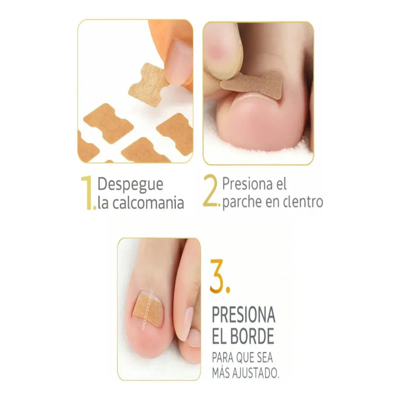 Pack 60 Parches Correctores Reparador De Uñas Encarnadas