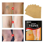 Pack X2 Parche De Pierna Para Tratamiento De Venas Varicosas Neutra
