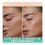 X5 Parches Mascarilla Hidrosolubles De Colágeno Antiarrugas Mixta