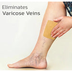 Parche De Pierna Para Tratamiento De Venas Varicosas Neutra